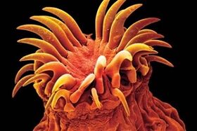 الطفيليات تريماتودا في البشر